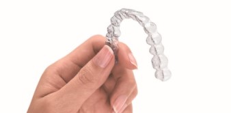 インビザライン